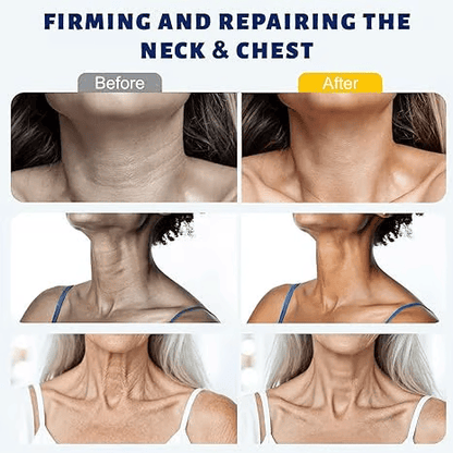 Roller Massage Neck Cream 🧴 Collagen & Hyaluronic Acid – Roller Mass… – ✨ Lift,
